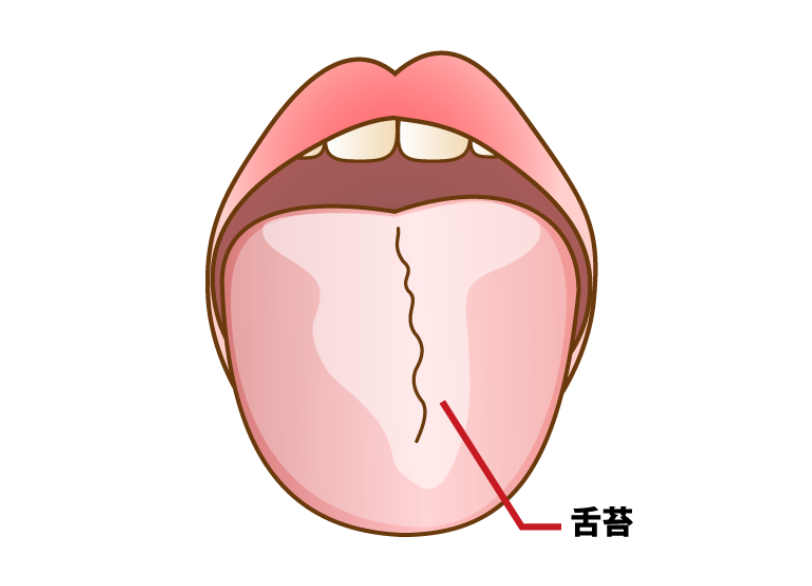 舌苔|中西歯科
