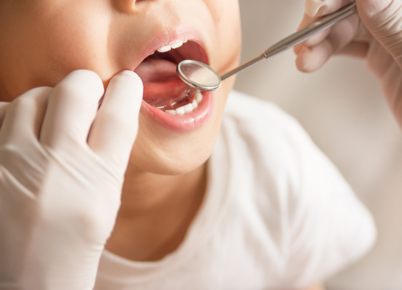 無理強いはしません|中西歯科