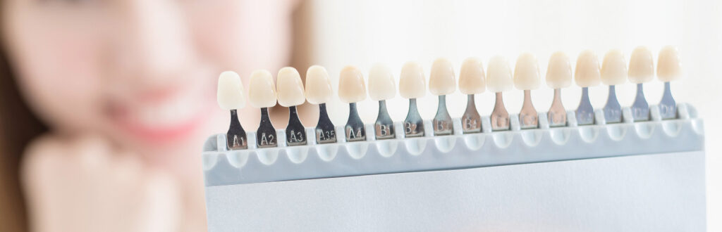 ホワイトニングをお考えの方へ|中西歯科