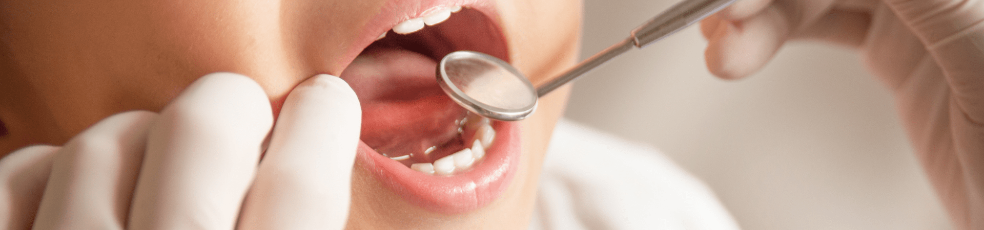 症状から探す小児歯科｜中西歯科