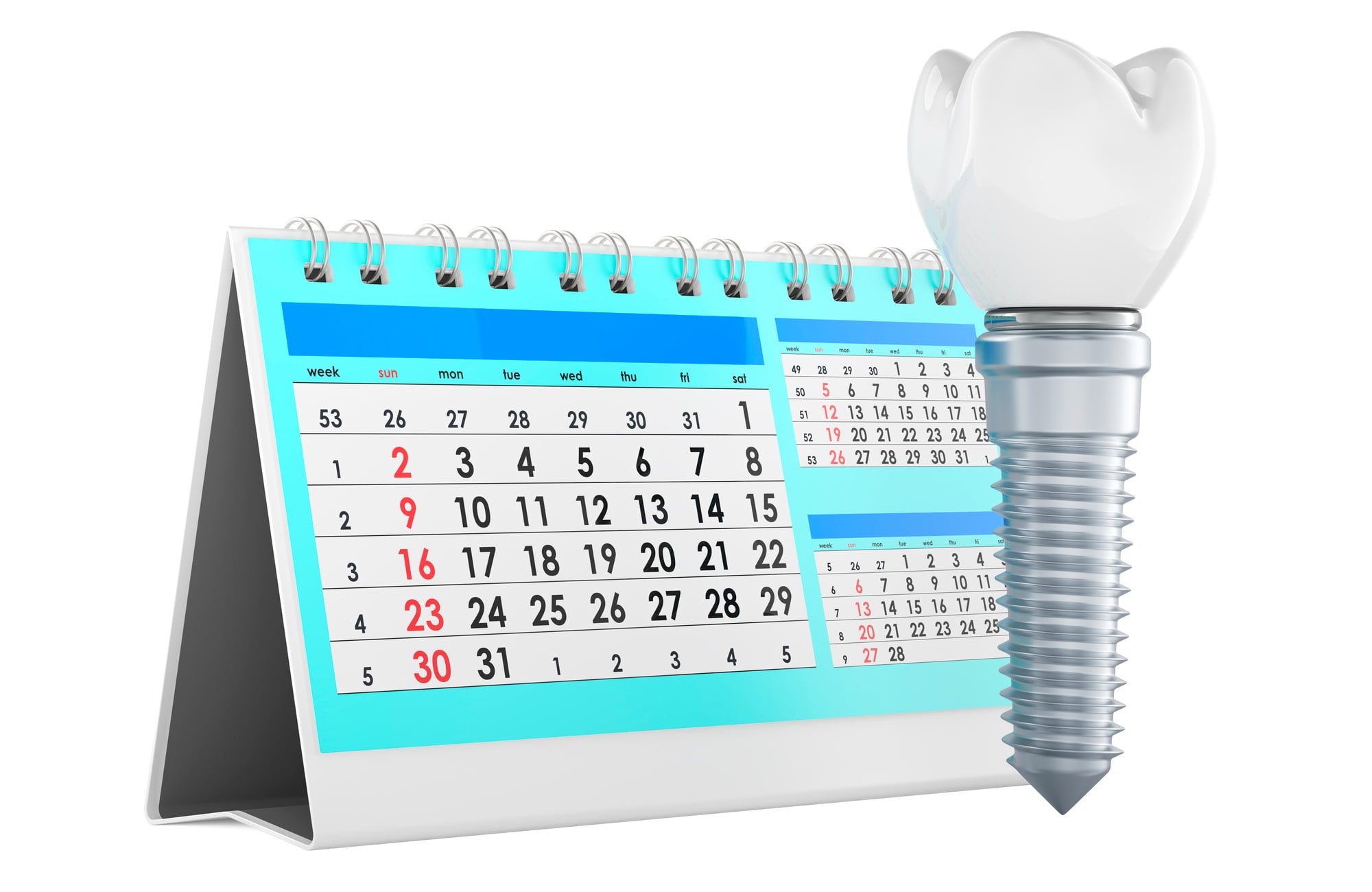 インプラント治療にかかる期間のイメージ