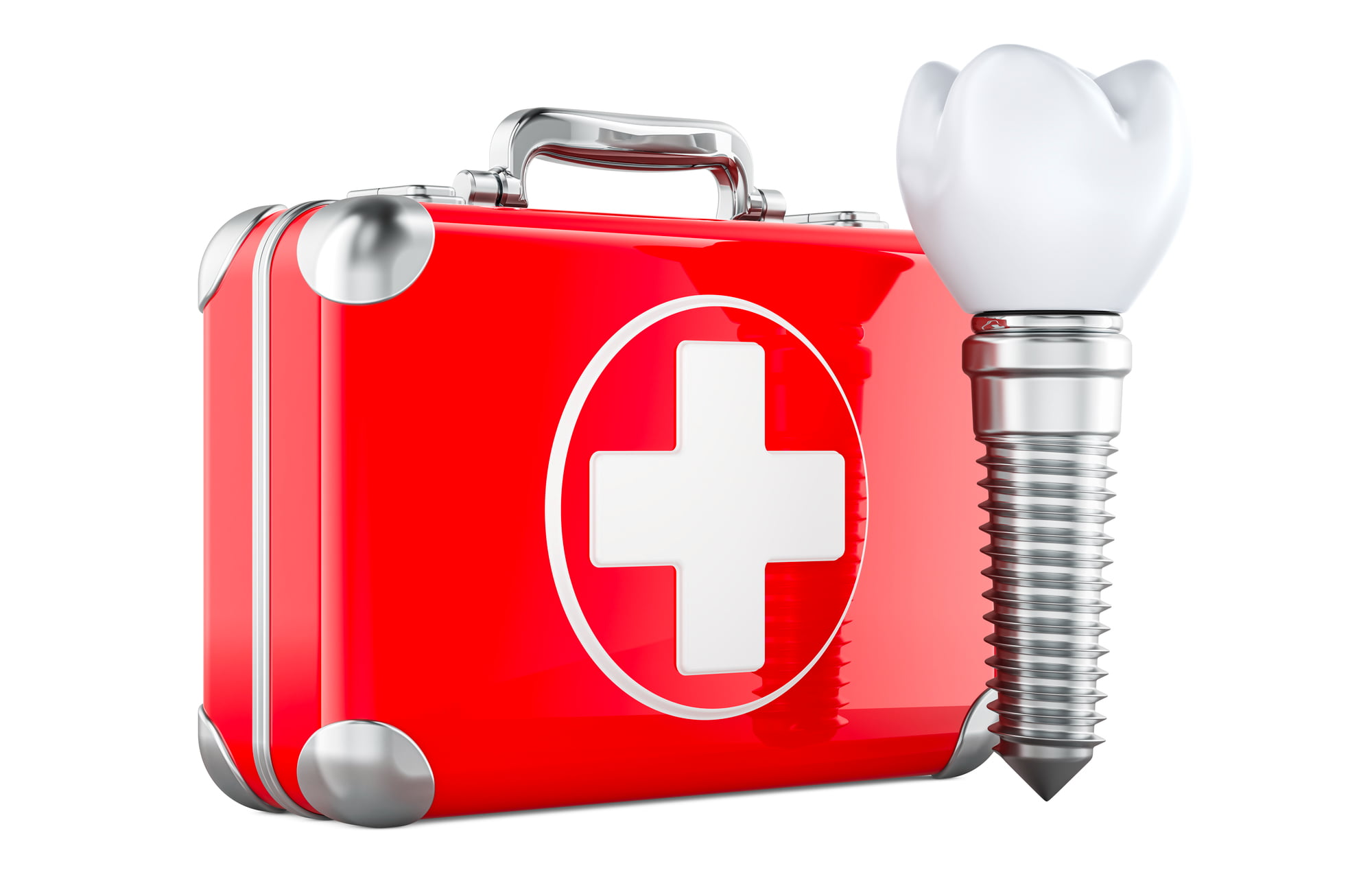 インプラント治療のイメージ