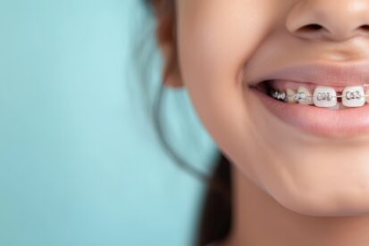 すきっ歯が気になり矯正治療をする子ども