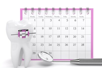 ワイヤー矯正の治療期間を説明するイメージ