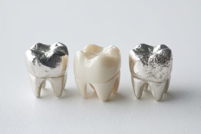 銀歯とセラミックの歯