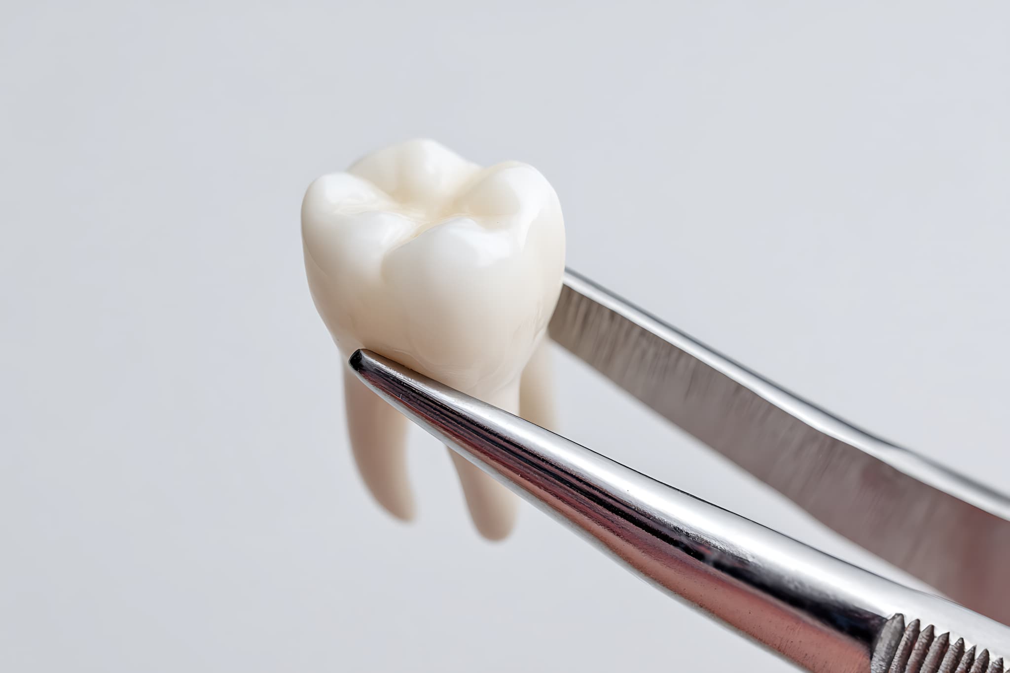 抜歯した親知らず