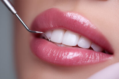 歯の綺麗な女性