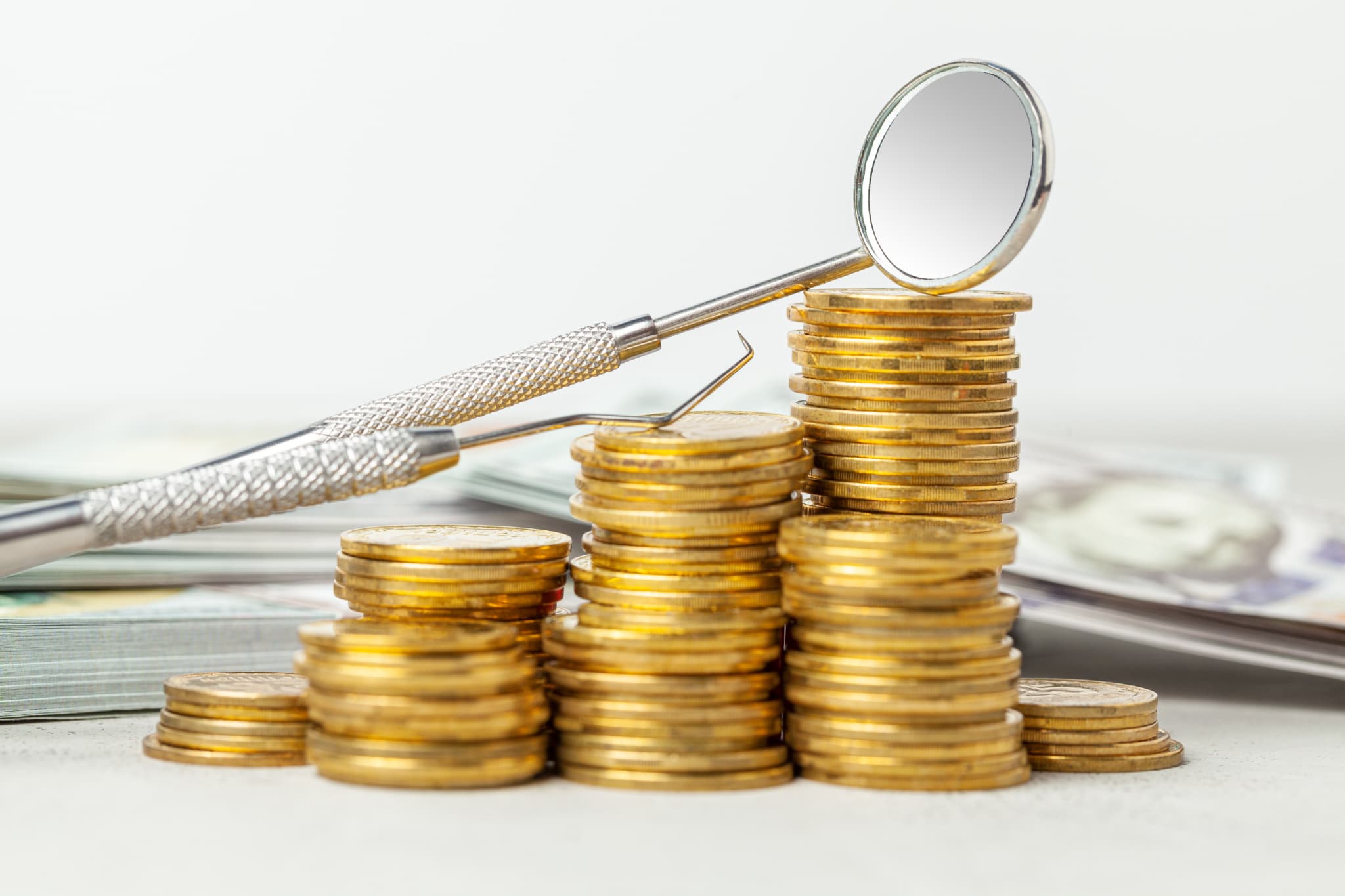 歯周外科治療にかかる費用を示す歯科医療器具と金貨の山