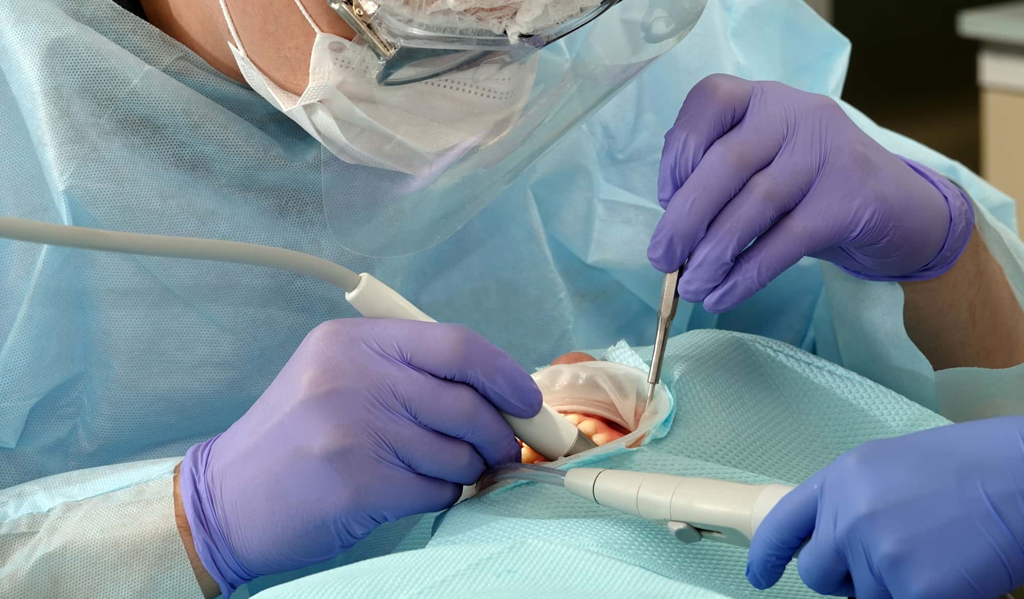 歯周外科治療中の歯科医と患者