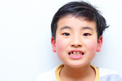出っ歯の男の子