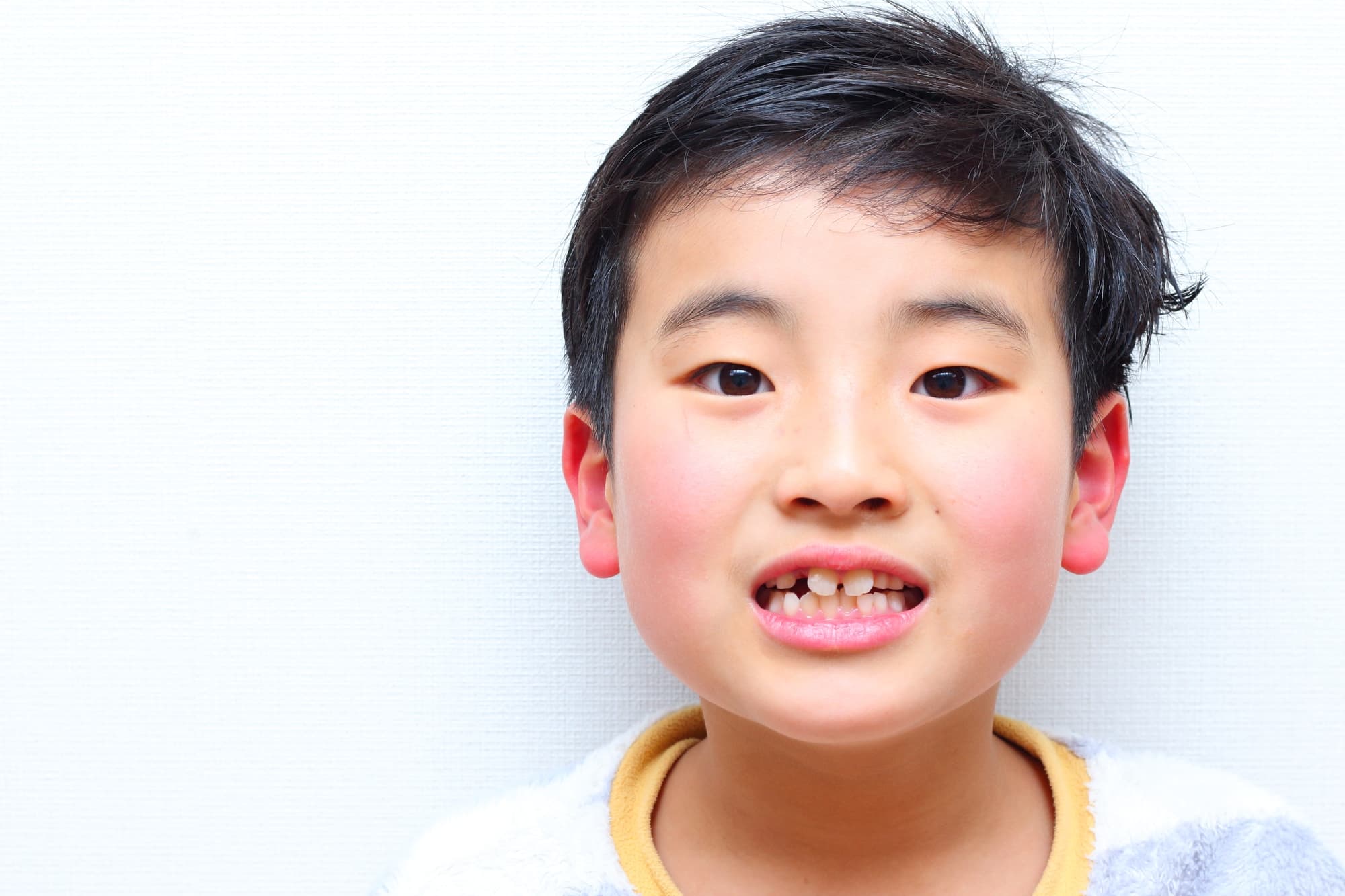出っ歯の男の子